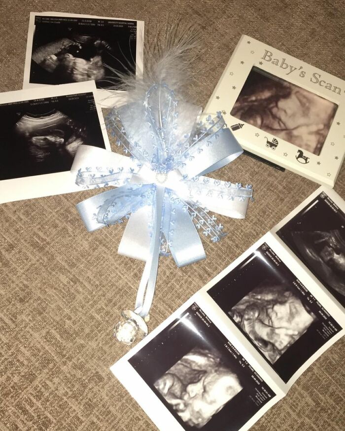 Teen Mom Who Got Pregnant At 14 Defies The Odds And Aces Her Exams