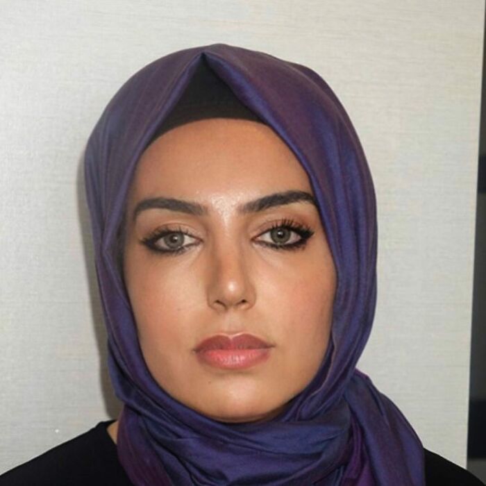 Before And After Photos From Turkish Plastic Surgery Clinic Have Left People Baffled Before And After Photos From Turkish Plastic Surgery Clinic Have Left People Baffled