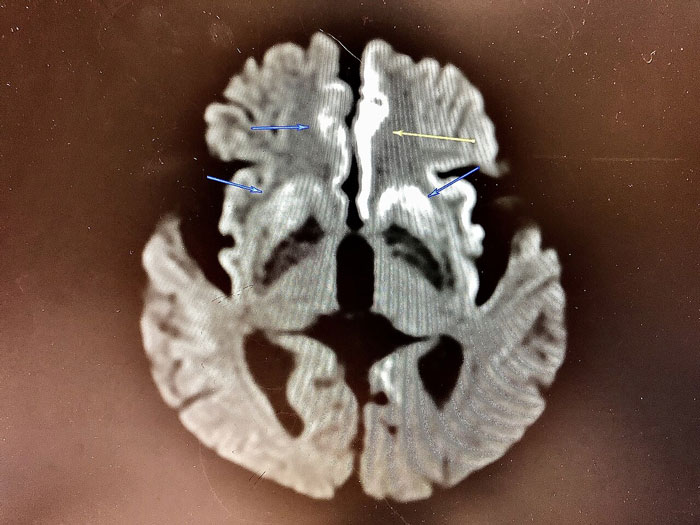 People Share 30 "Genuinely Terrifying" Facts