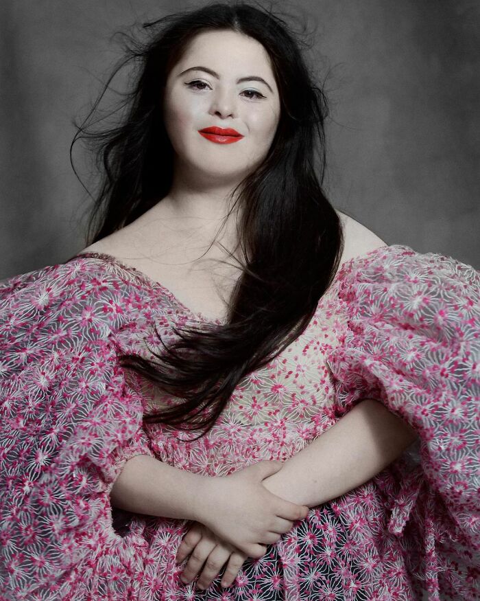 Woman With Down&rsquo;s Who Was Given 0 Prospects At Birth Now Models For Gucci And Vogue