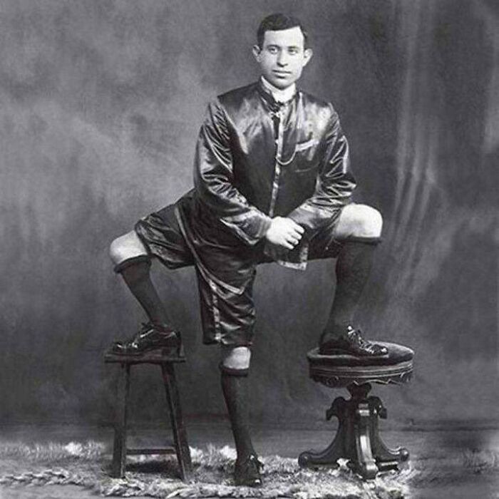 This Is Francesco Lentini, The 3 Legged Man. The Italian-American Circus Performer Was Born With 3 Legs, 4 Feet And 2 Sets Of Functioning Genitals. He Spent His Years Working For The Circus And Lived Until The Age Of 77