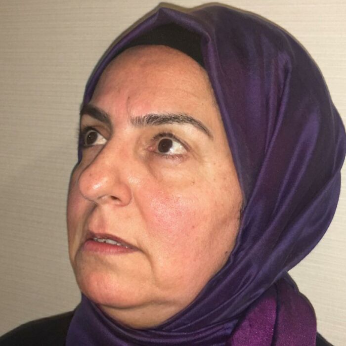 Before And After Photos From Turkish Plastic Surgery Clinic Have Left People Baffled Before And After Photos From Turkish Plastic Surgery Clinic Have Left People Baffled