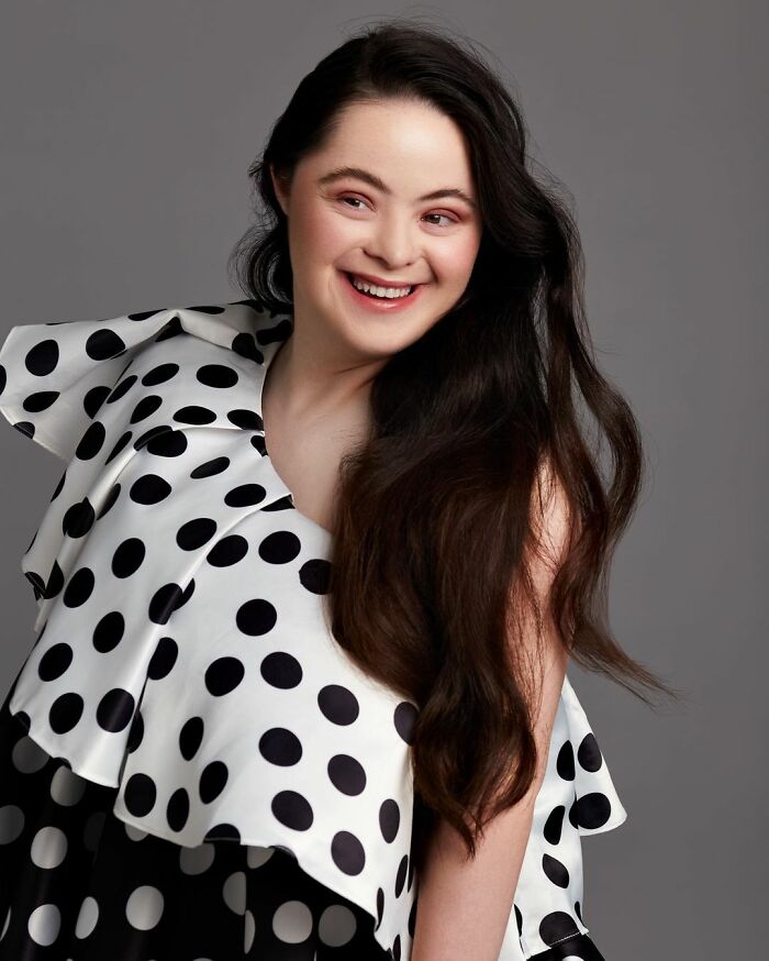 Woman With Down&rsquo;s Who Was Given 0 Prospects At Birth Now Models For Gucci And Vogue