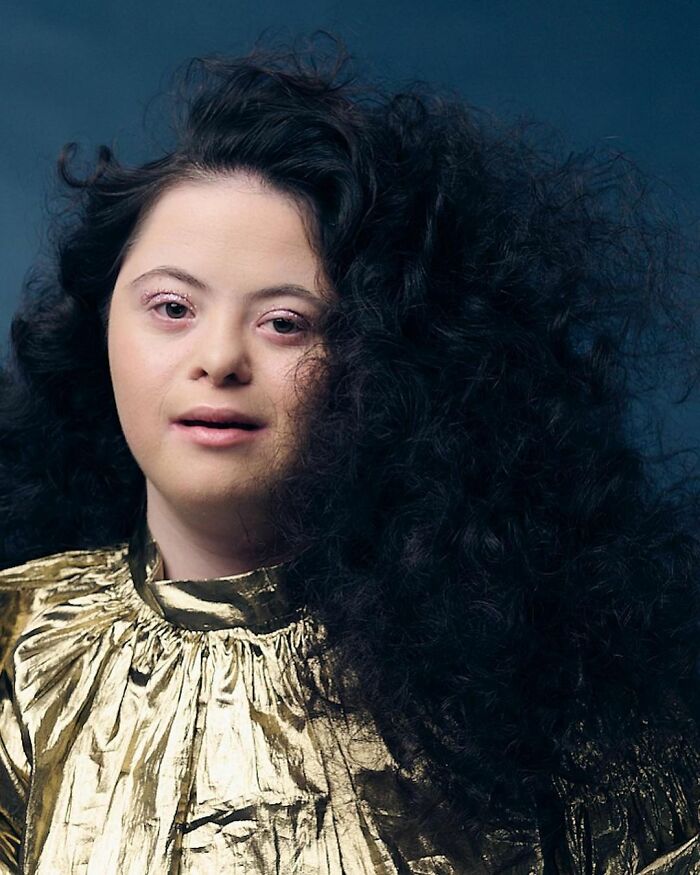 Woman With Down&rsquo;s Who Was Given 0 Prospects At Birth Now Models For Gucci And Vogue