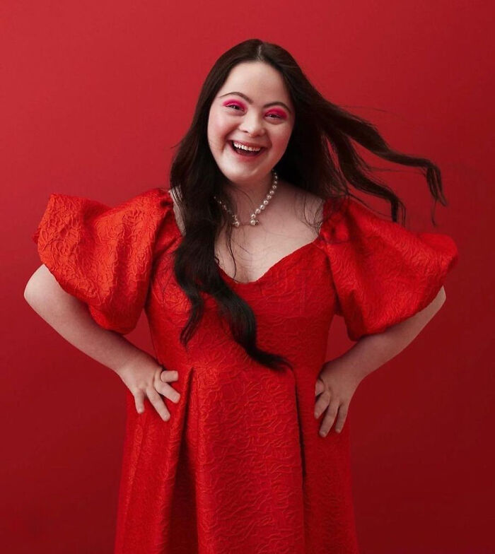 Woman With Down&rsquo;s Who Was Given 0 Prospects At Birth Now Models For Gucci And Vogue