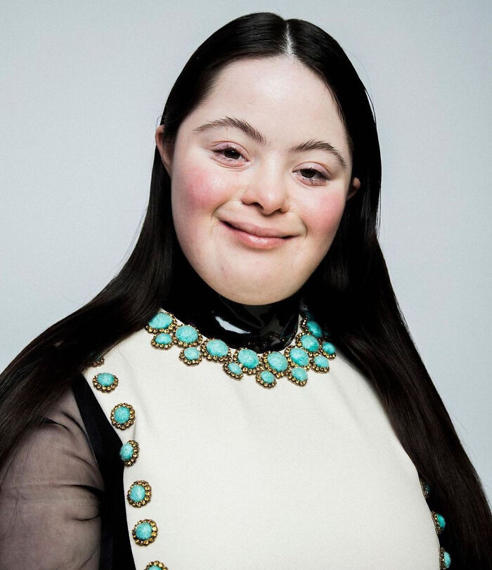 Woman With Down&rsquo;s Who Was Given 0 Prospects At Birth Now Models For Gucci And Vogue