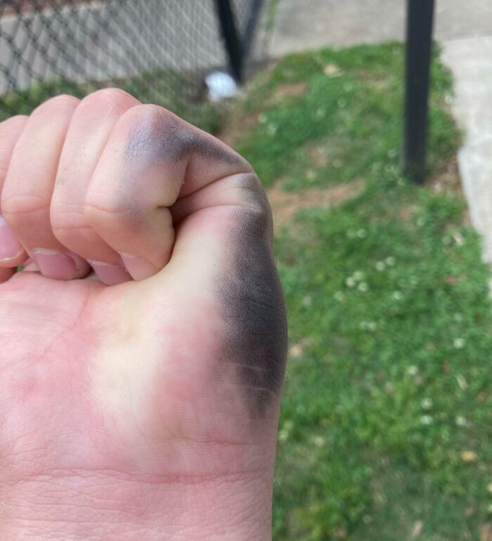 Left-Handed People Know The Pain