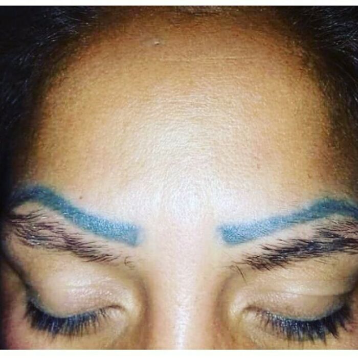 Blue tattooed eyebrows on closed eyes showcasing an ink failure.