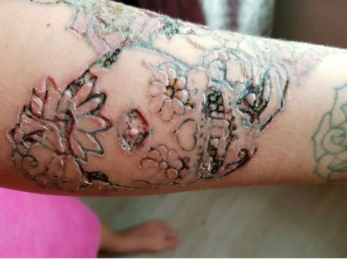 Close-up of a healing tattoo on an arm displaying intricate flower designs, highlighting lessons in tattoo failures.
