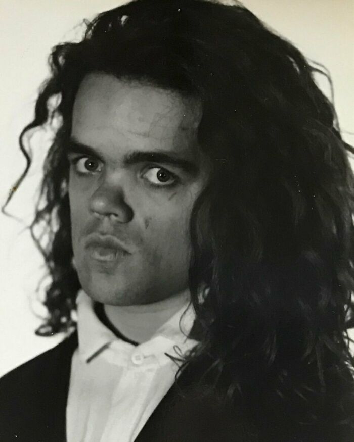 A Young Peter Dinklage With Grown-Out Hair, 1980s