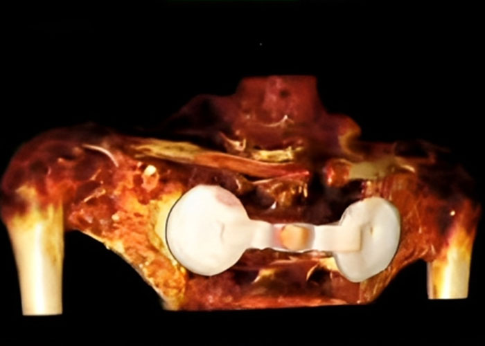 Millennium-Old 'Alien Corpses' Undergo Lab Tests: Mexican Doctors Claim Bodies Are Complete Skeletons