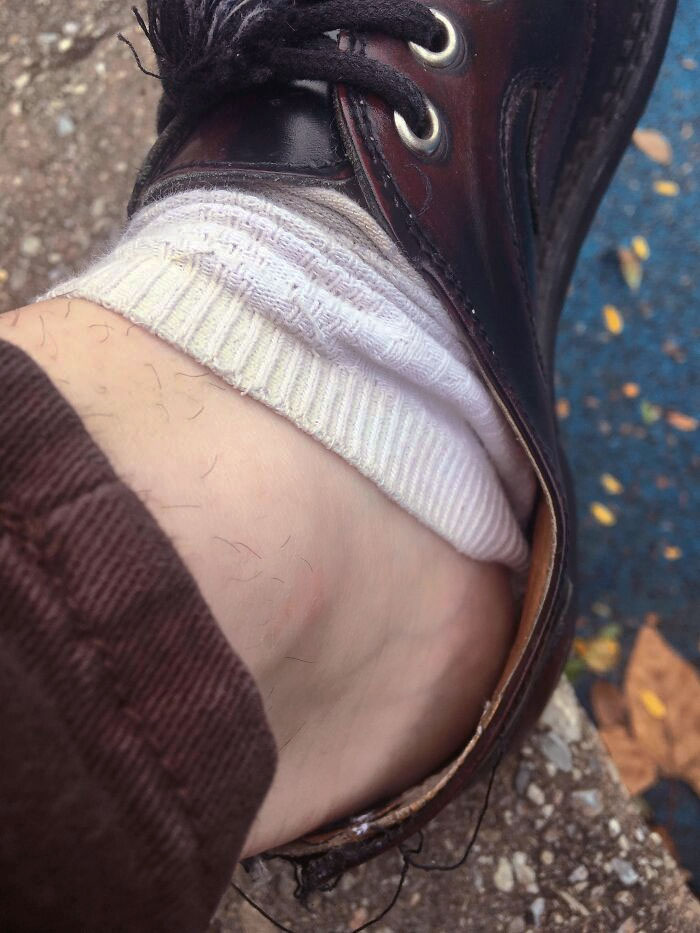 When Your Sock Falls Into Your Shoe