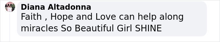 Woman With Down&rsquo;s Who Was Given 0 Prospects At Birth Now Models For Gucci And Vogue