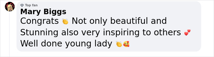 Woman With Down&rsquo;s Who Was Given 0 Prospects At Birth Now Models For Gucci And Vogue