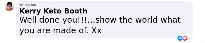 Woman With Down&rsquo;s Who Was Given 0 Prospects At Birth Now Models For Gucci And Vogue