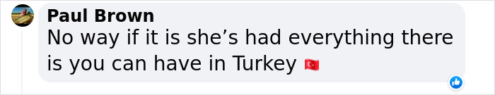 Before And After Photos From Turkish Plastic Surgery Clinic Have Left People Baffled Before And After Photos From Turkish Plastic Surgery Clinic Have Left People Baffled