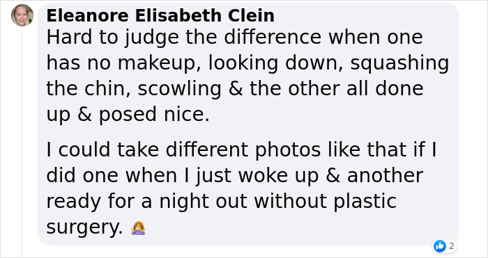 Before And After Photos From Turkish Plastic Surgery Clinic Have Left People Baffled Before And After Photos From Turkish Plastic Surgery Clinic Have Left People Baffled