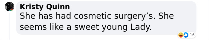 Ariana Grande Admits Using Botox and Lip Fillers To Change Her Appearance In The Past