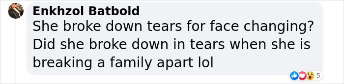 Ariana Grande Admits Using Botox and Lip Fillers To Change Her Appearance In The Past