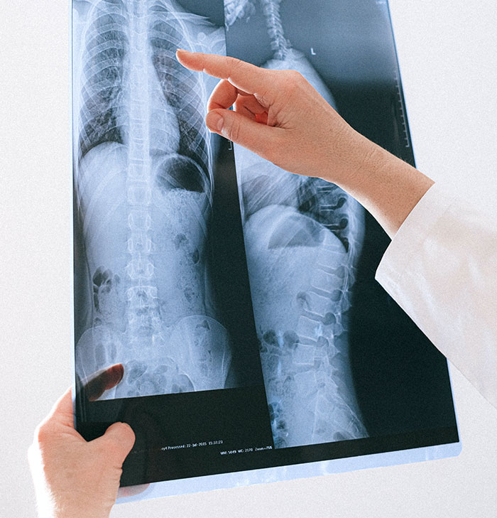 “What Is The Stupidest Reason You Went To Hospital?” (35 Answers)