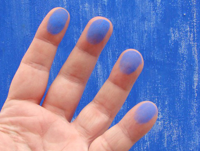 “What Is The Stupidest Reason You Went To Hospital?” (35 Answers)