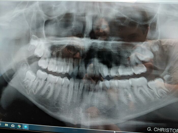 50 Things People Thought Were 'Normal' About Their Bodies Until They Realized They Weren't