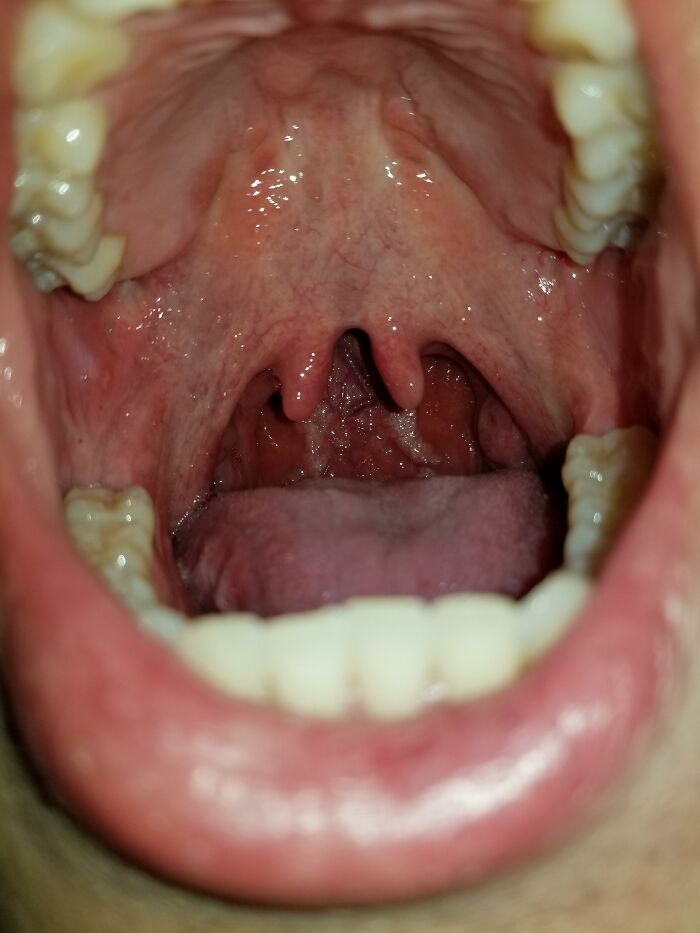 50 Things People Thought Were 'Normal' About Their Bodies Until They Realized They Weren't