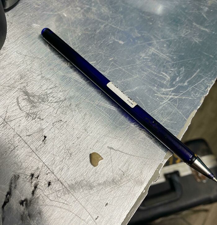 My Coworker Found A Tooth In His Sandwich's Lunch Meat