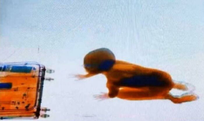 Unattended Toddler Crawled Inside An X-Ray Machine Scanner