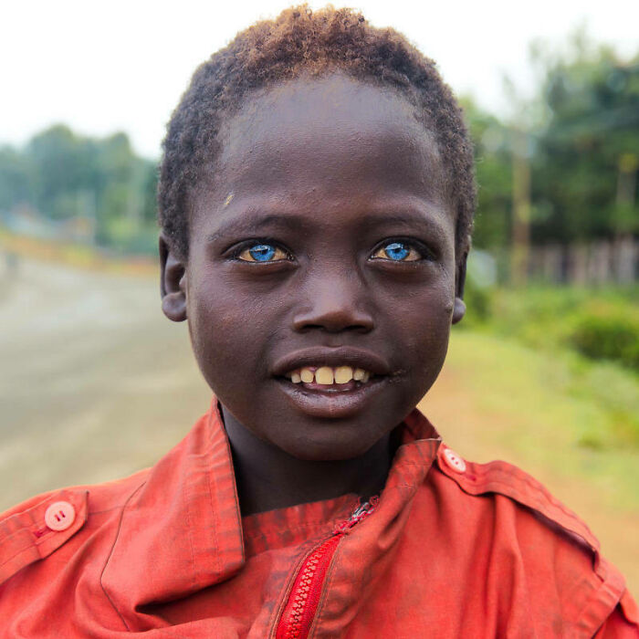 Ethiopian Beggar Boy With Blue Eyes On The Streets Of Jinka, By Mike Eloff 