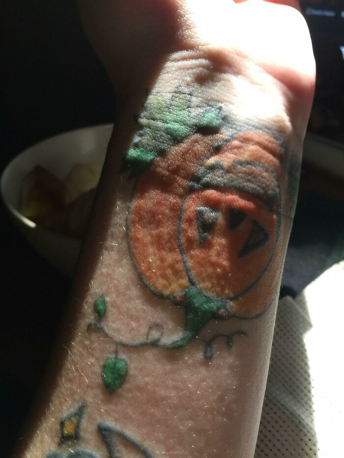 My Years Old Tattoo Becoming Raised/Bumpy/Itchy Due To Being Sick