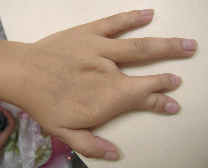 The Sign Of A Compulsive Liar