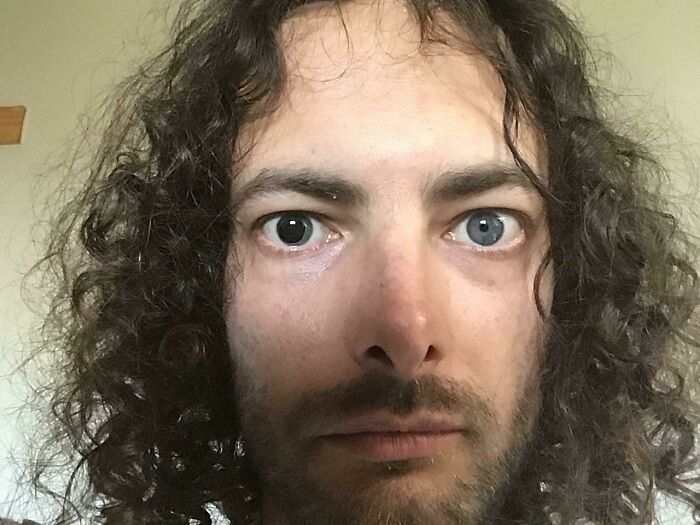 I Have A Permanently-Dilated Eye