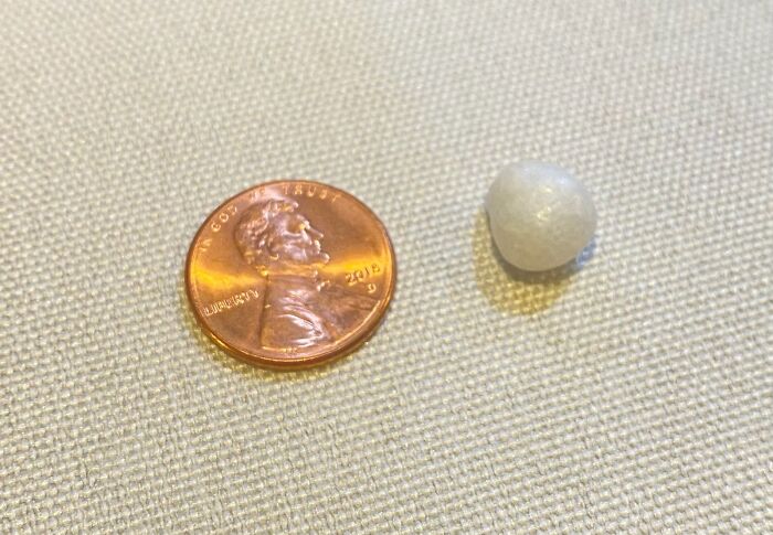 Ordered Fried Oysters From A Takeout Restaurant And Found A Pearl In One