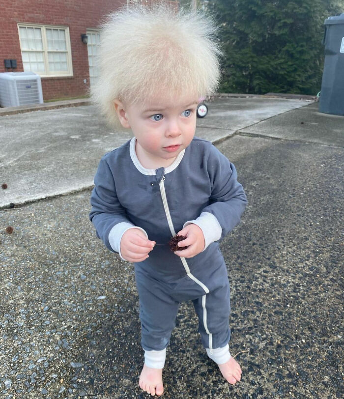 "Uncombable Hair Syndrome" Is A Rare And Harmless Condition That Disappears Around Puberty