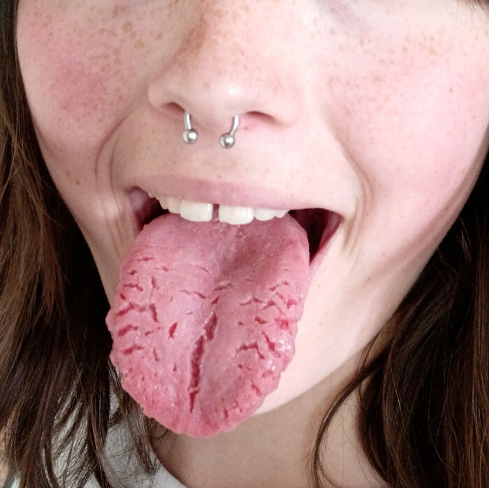 50 Things People Thought Were 'Normal' About Their Bodies Until They Realized They Weren't