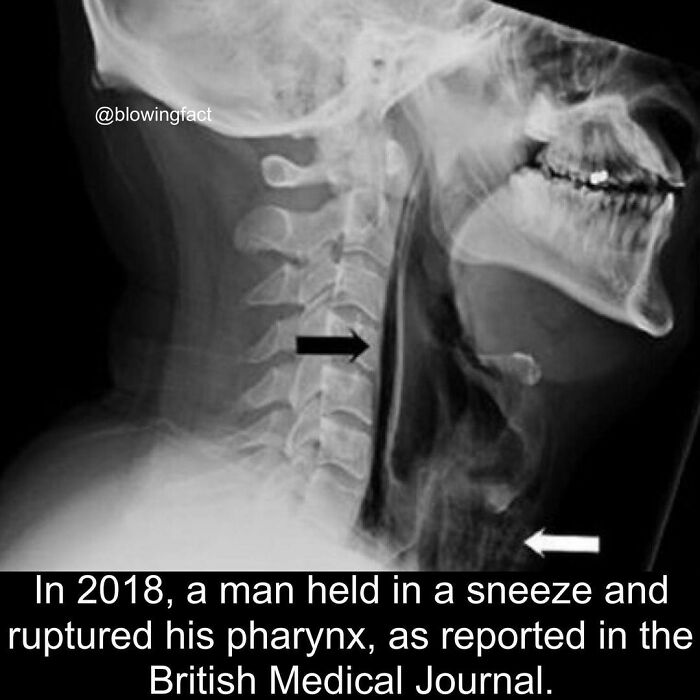 Interesting-Blowing-Facts-Pics