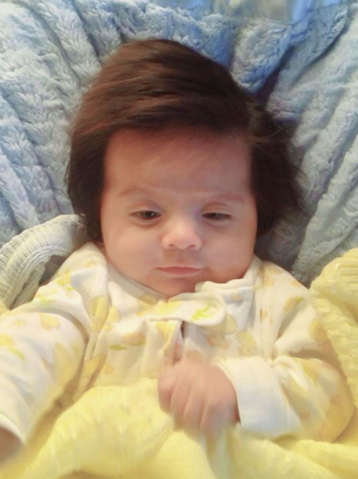 Two Months Old Baby, And It's Not A Wig