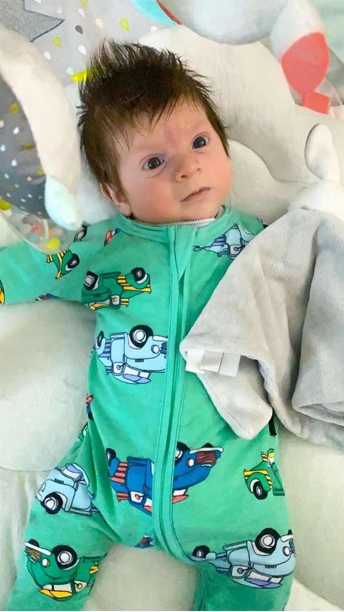 My Baby Has So Much Hair That We And Everyone At The Hospital Were Surprised