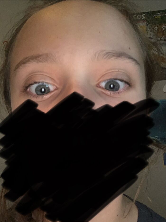 Top Part Of My Face Reveal