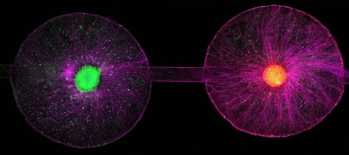 Honorable Mention - Dr. Arthur Chien And Dr. Ann Na Cho