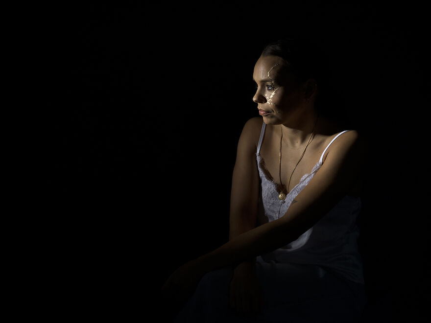 Kintsugi Beauty: Celebrating The Beauty Of Scars And Imperfections In Photography