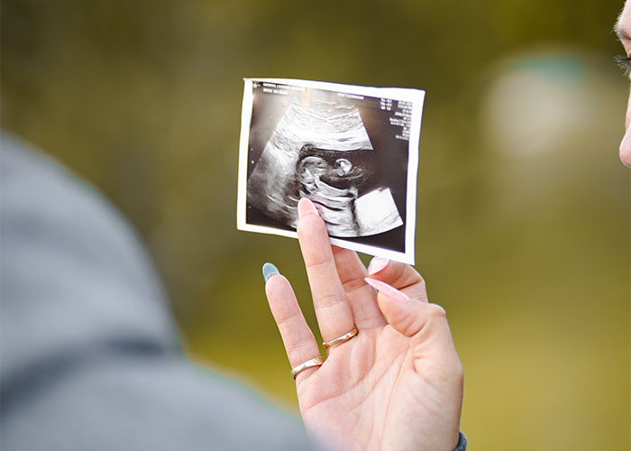 Guy Breaks Up With GF Of 3 Months Because She's Pregnant And He Doesn't Want To Be A Dad