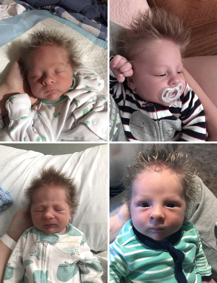 Everyone Was Wrong About His Hair Falling Out. Meet Fisher