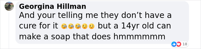 "It's So Surreal": 14-Year-Old Invents Soap That Treats Skin Cancer And Wins Science Award "It's So Surreal": 14-Year-Old Invents Soap That Treats Skin Cancer And Wins Science Award