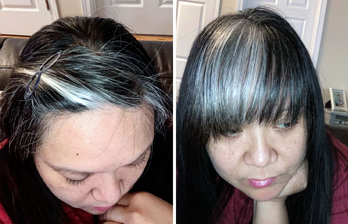 I Just Found Out That My Chunk Of Gray Hair Is Called "Mallen Streak", Or Also Known As Poliosis