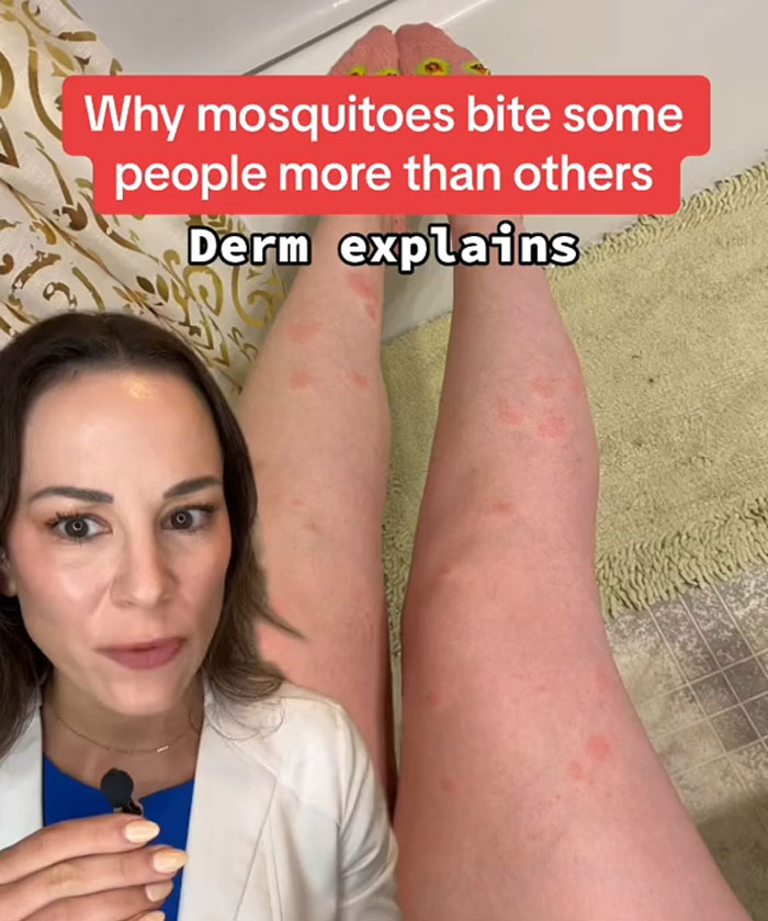 Dermatologist Explains What People Are &lsquo;Mosquito Magnets&rsquo; And How To Avoid The Annoying Bugs