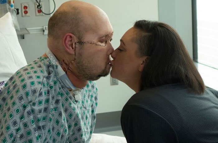 &ldquo;I Don&rsquo;t Want To Wear A Mask&rdquo;: Veteran Who Lost Half Of His Face Receives Eyeball Transplant