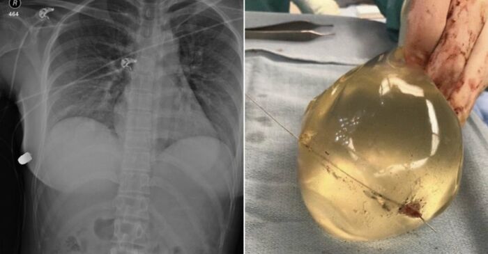 35 Morbid Facts That Might Teach You Something New Or Ruin Your Day