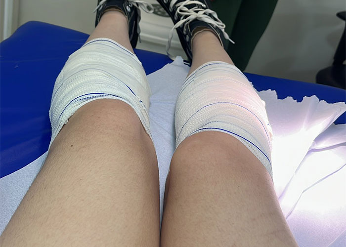 Fans Suffered From “Second-Degree Burns” At Taylor Swift’s Show Where Conditions Were “Inhumane” Fans Suffered From “Second-Degree Burns” At Taylor Swift’s Show Where Conditions Were “Inhumane”